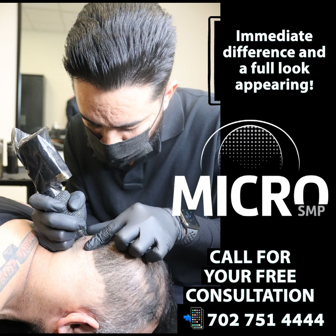 MicroSMP Scalp Micropigmentation - Mens Hair loss Solutions | Hair Transplant | Las Vegas, NV