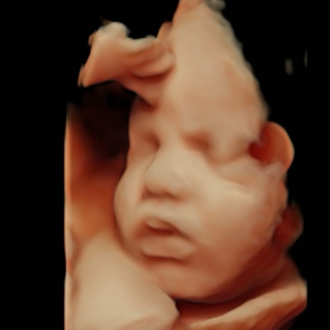 Sentiments 4D Ultrasound Studio | IVF | Pocatello, ID