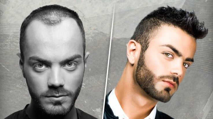 Hair Forever, LLC | Hair Transplant | North Little Rock, AR