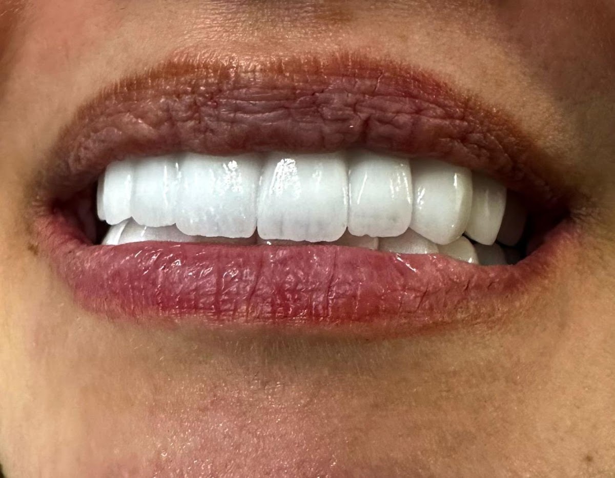 RO Dental Clinic — Dr.Visor photo 5