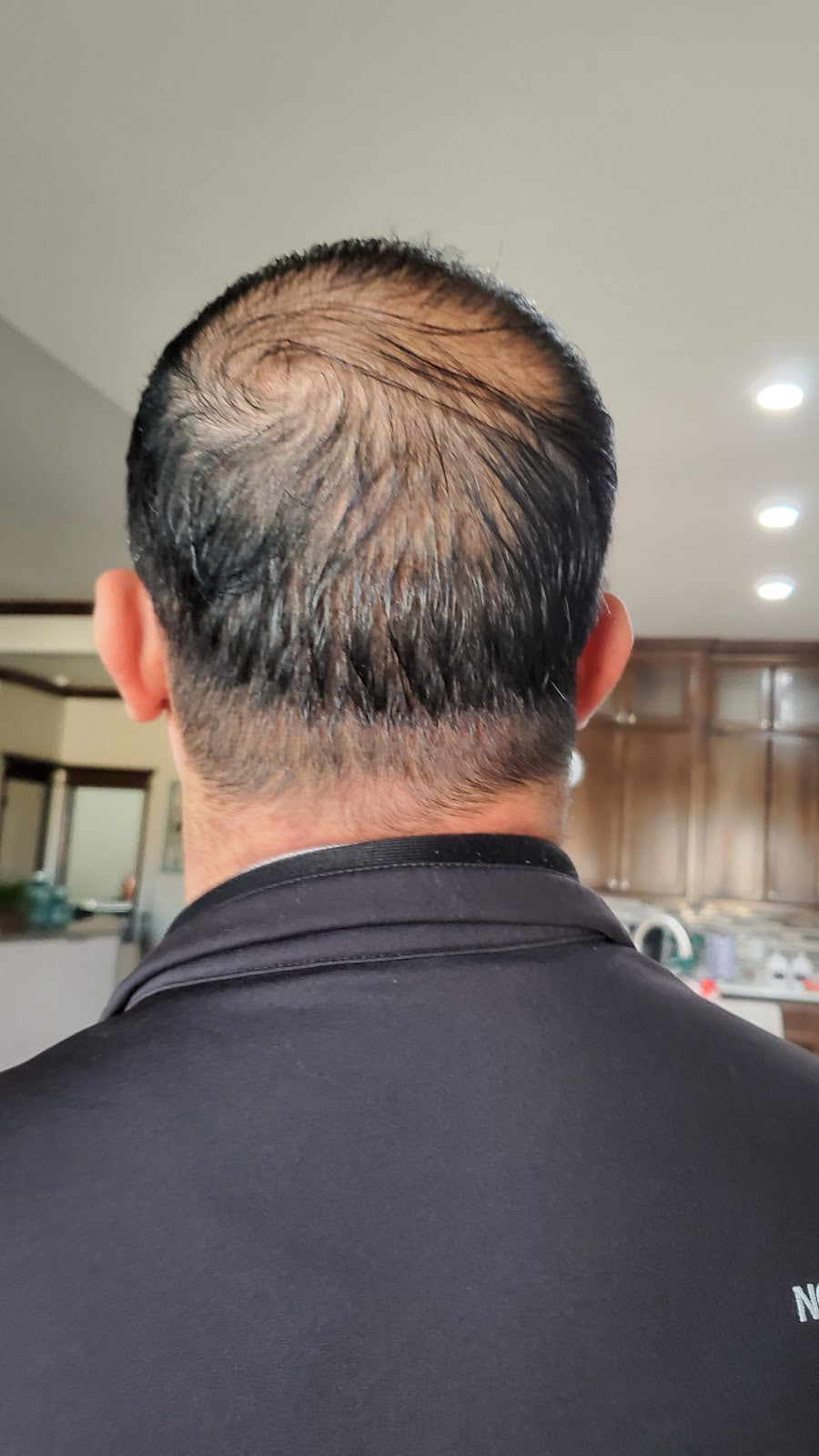Great Hair Restoration of | Hair Transplant | Oklahoma City, OK