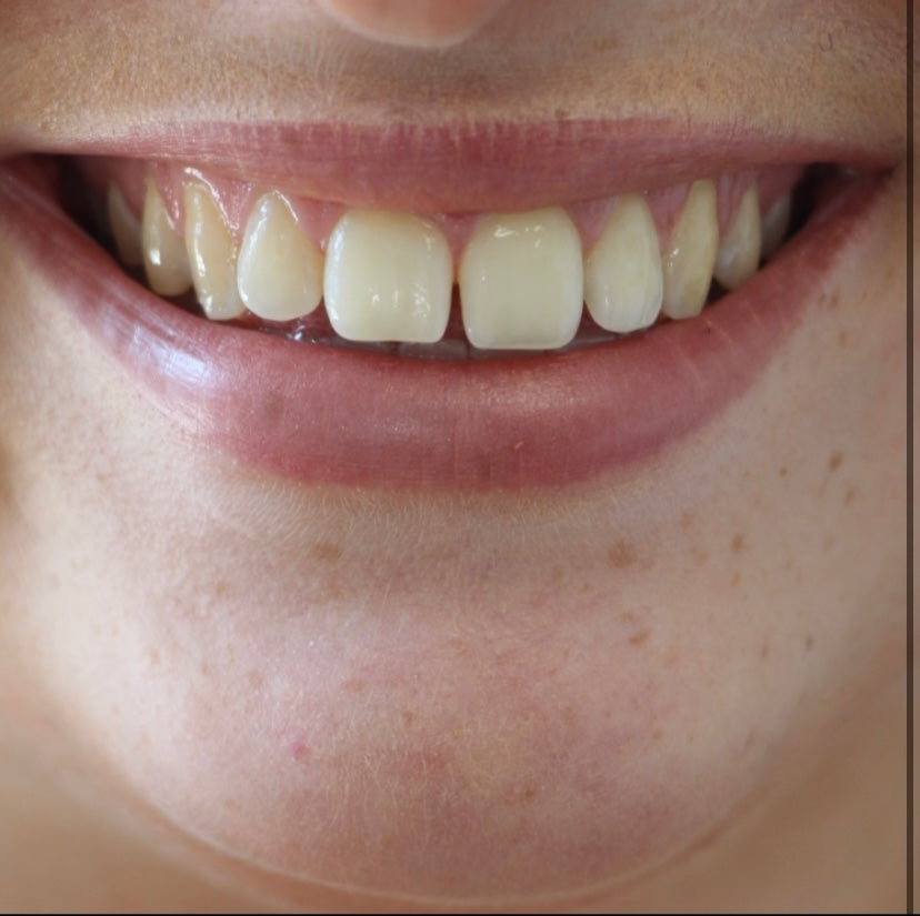 All saints Dental Implant and Orthodontic clinic Birmingham — photo 5
