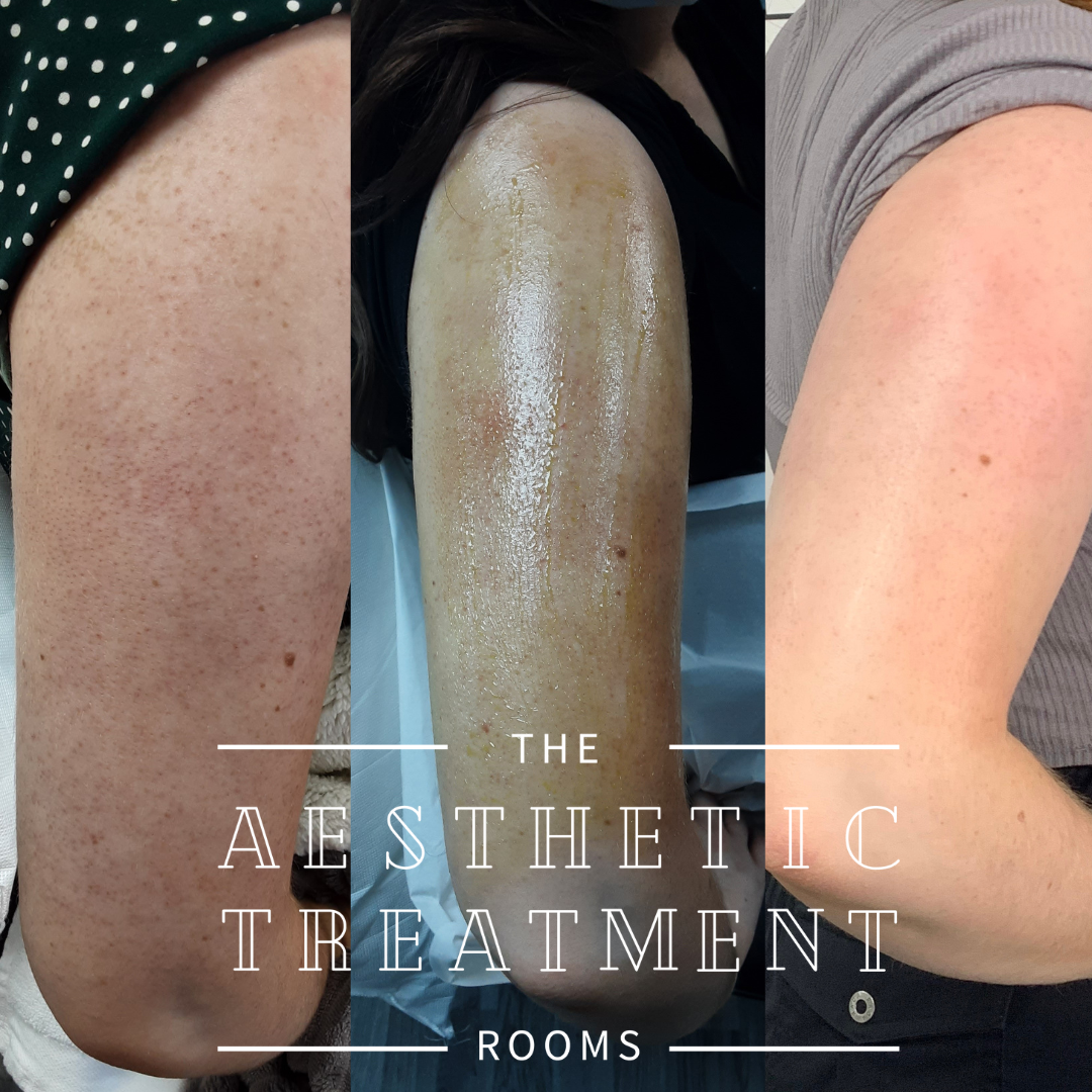 The Aesthetic Treatment Rooms — photo 4