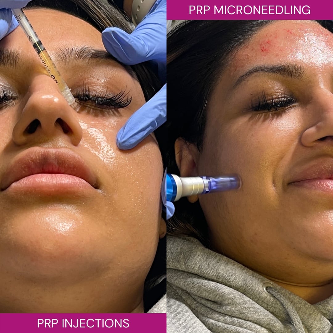 The Glam Fairies | Aesthetic Clinic | Microneedling Birmingham | PRP Birmingham | Chemical Peel Birmingham — photo 2