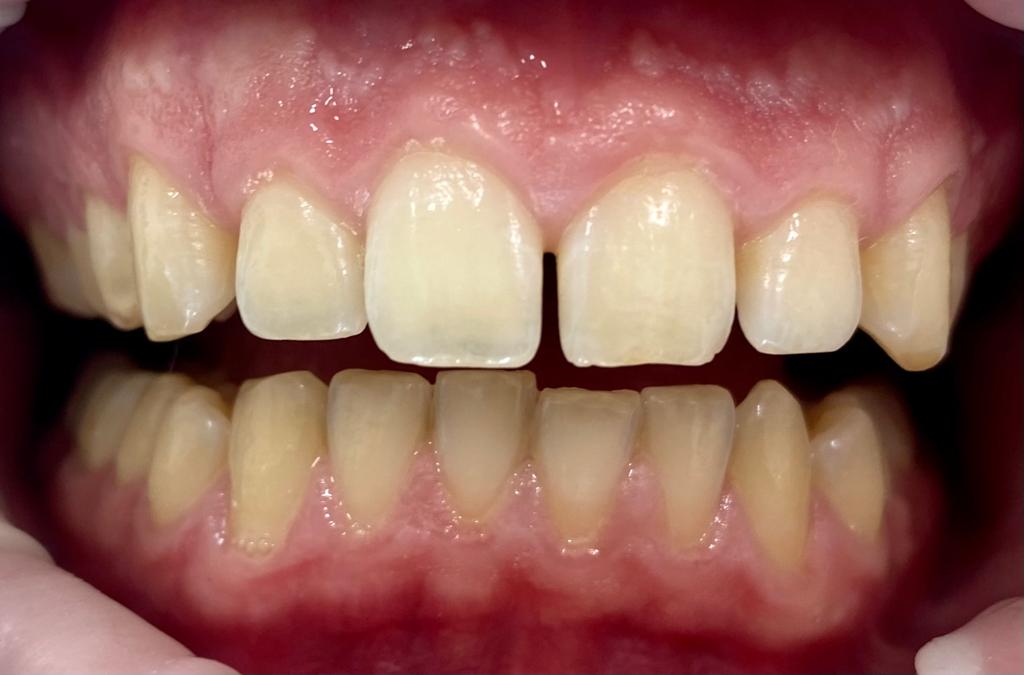 Mandarindent - Bodrum Diş Kliniği – Diş Tedavileri – Diş İmplantı – Estetik Diş Hekimliği — Dr.Visor photo 4