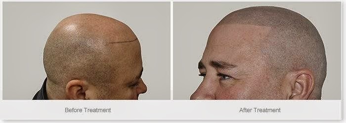 HIS Hair Clinic — photo 3