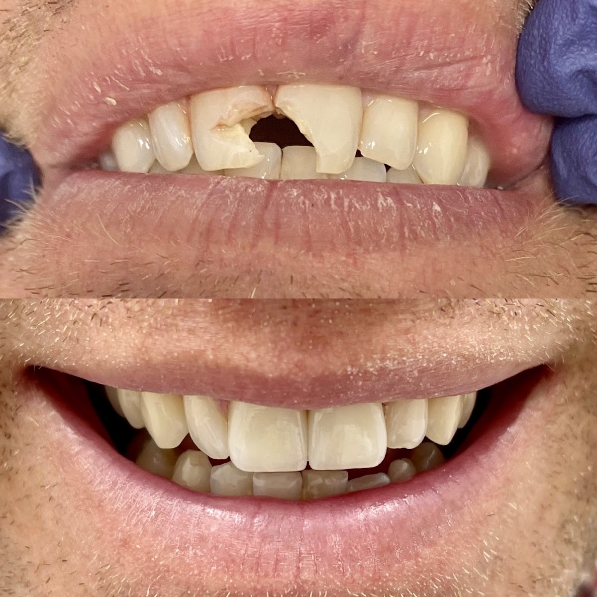 True Dental | Dental | Milwaukee, WI