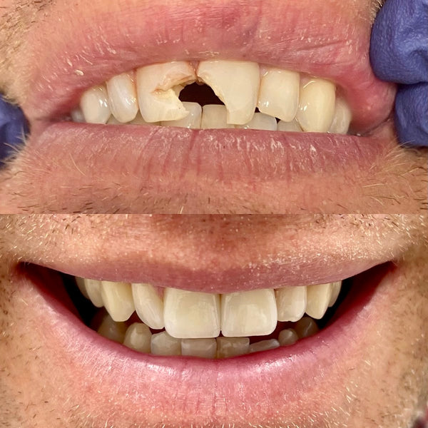 True Dental | Dental | Milwaukee, WI