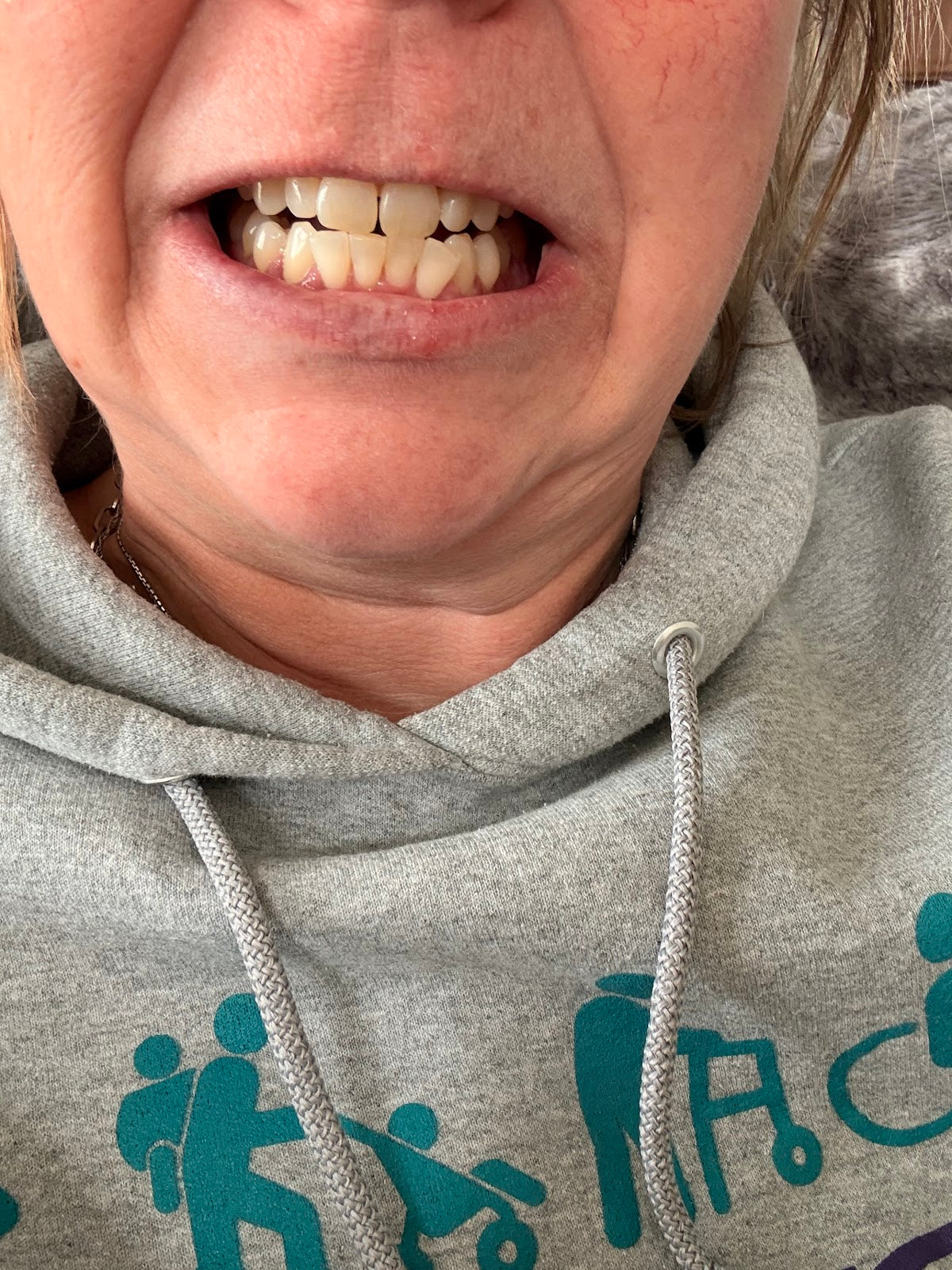 NEW Aesthetics | Aesthetic Surgery | Green Bay, WI