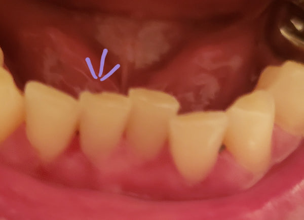 Stacey Family Dental…. Retired | Dental | Bellevue, NE