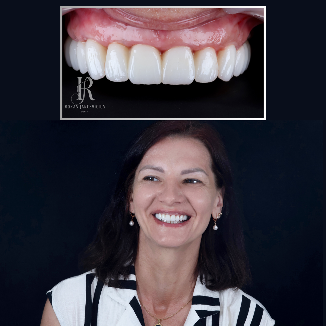 Complex Smile implant centre — photo 5