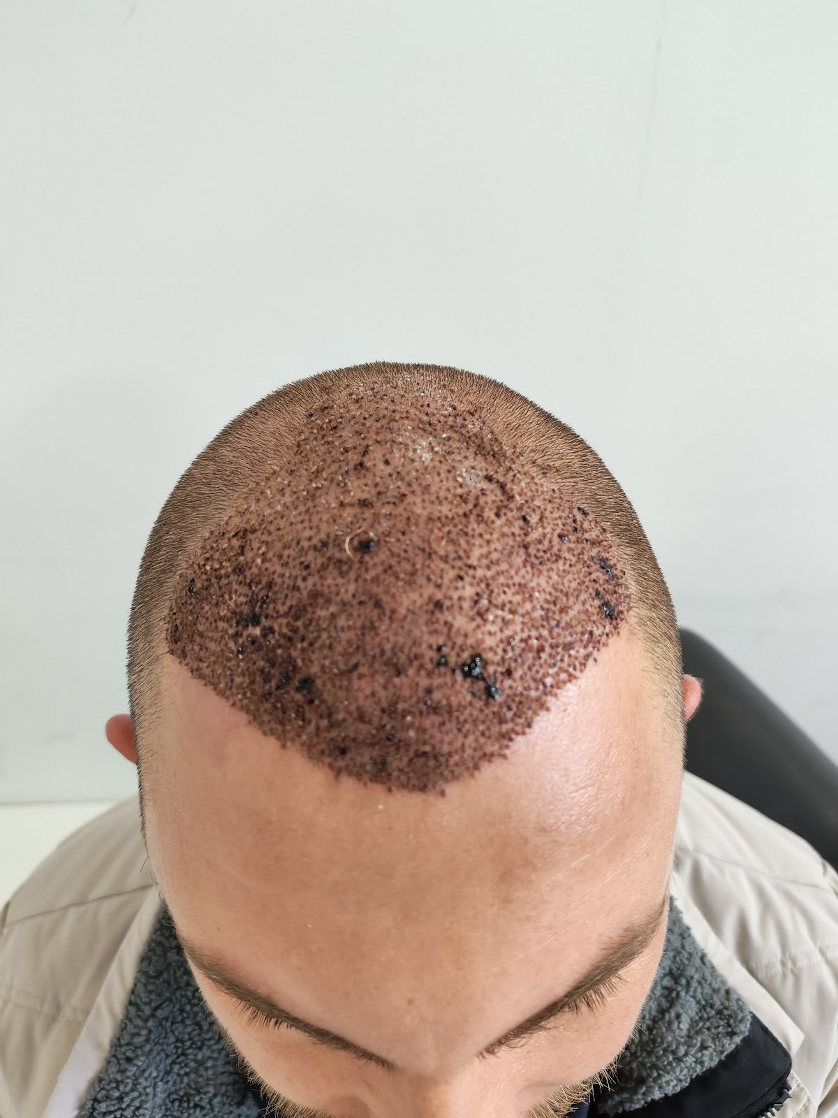 Erna Hair Clinic İzmir Saç Ekim Merkezi — Dr.Visor photo 2
