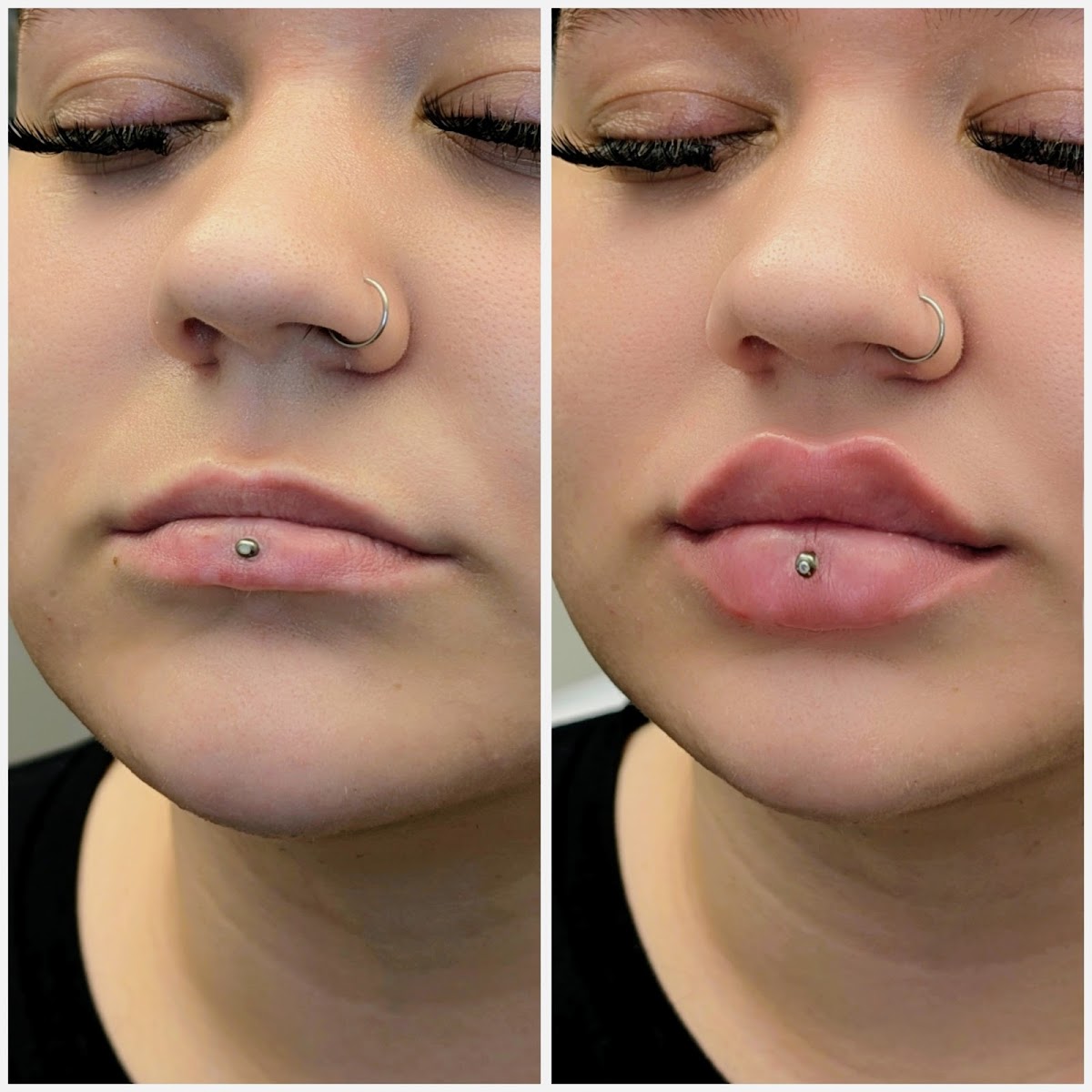 Beauty Five GmbH - Ästhetische Medizin auf der Königstraße in Stuttgart - Aesthetic Surgery clinic in Stuttgart, Germany