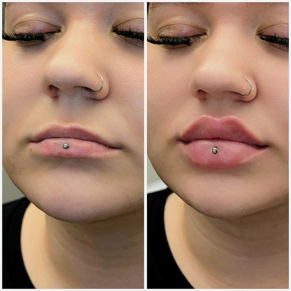Beauty Five GmbH - Ästhetische Medizin auf der Königstraße in Stuttgart | Aesthetic Surgery | Stuttgart