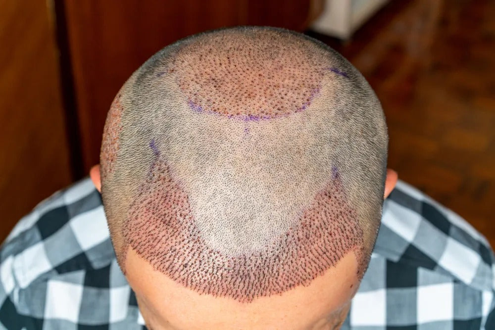 Ultra Hair Clinic — photo 4
