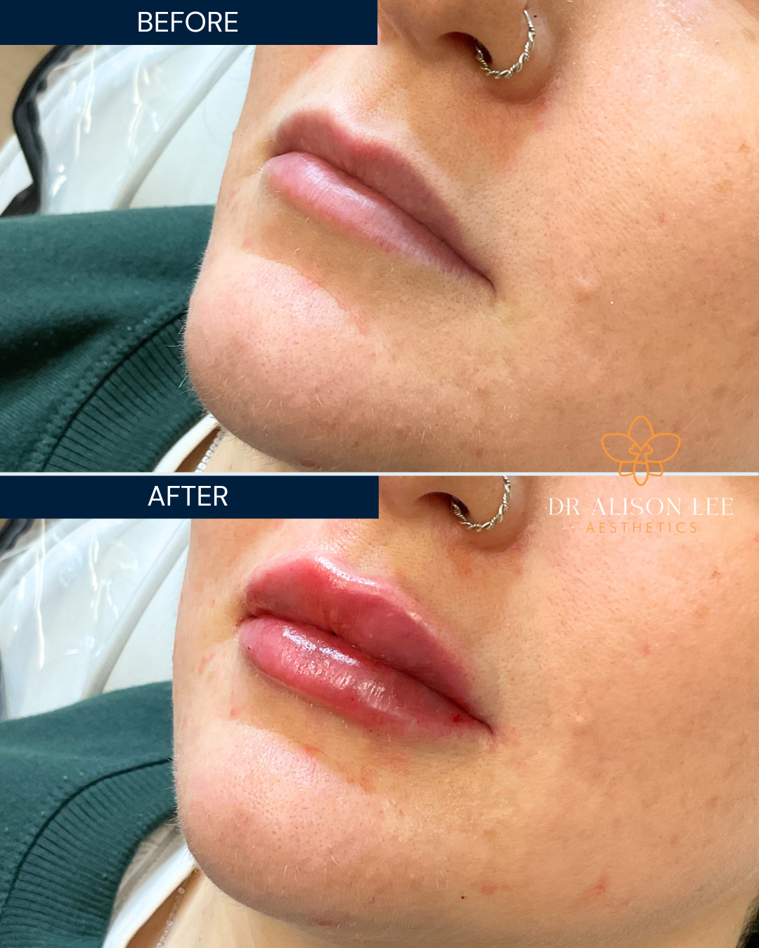 Dr Alison Lee Aesthetics - Aesthetic Surgery clinic in Sheffield, United Kingdom
