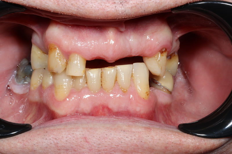 New Life Teeth - Dental Implants Clinic — photo 3