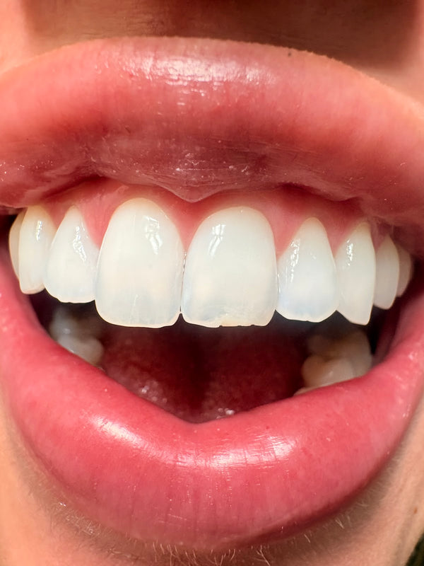 Celebrate Dental & Braces | Dental | Independence, MO
