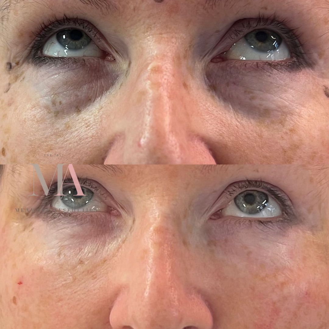 Meamore Aesthetics — Aesthetic Surgery Clinic in Leeds