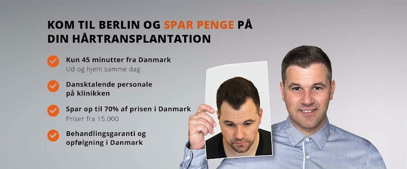 Fueklinikken Hårtransplantation | Hair Transplant | 1552 København