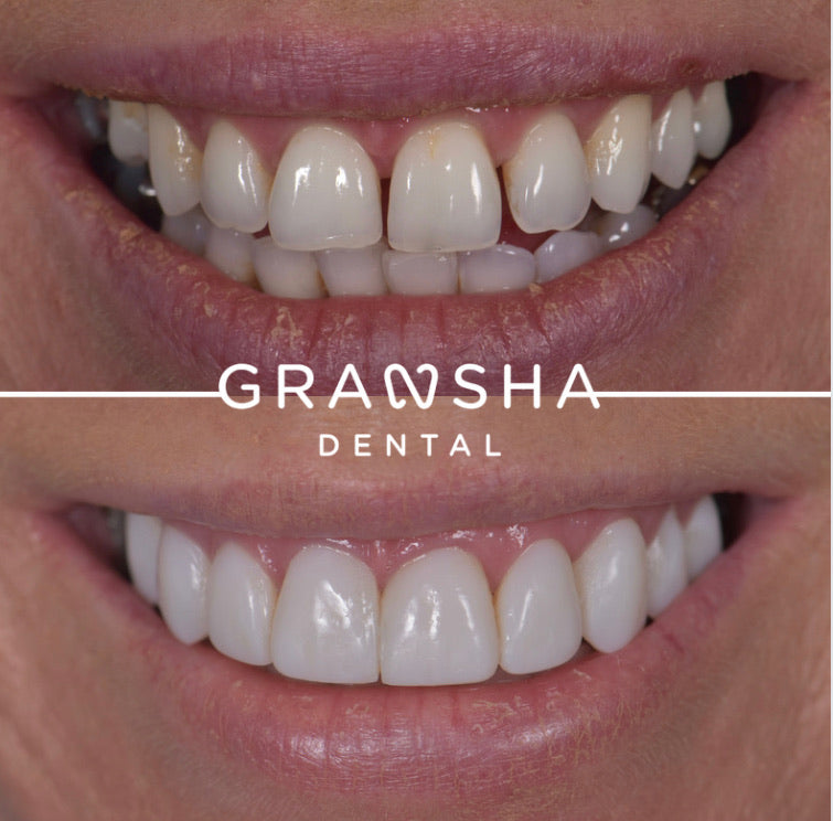 Gransha Dental - Dental clinic in Belfast, United Kingdom