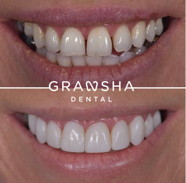 Gransha Dental | Dental | Belfast