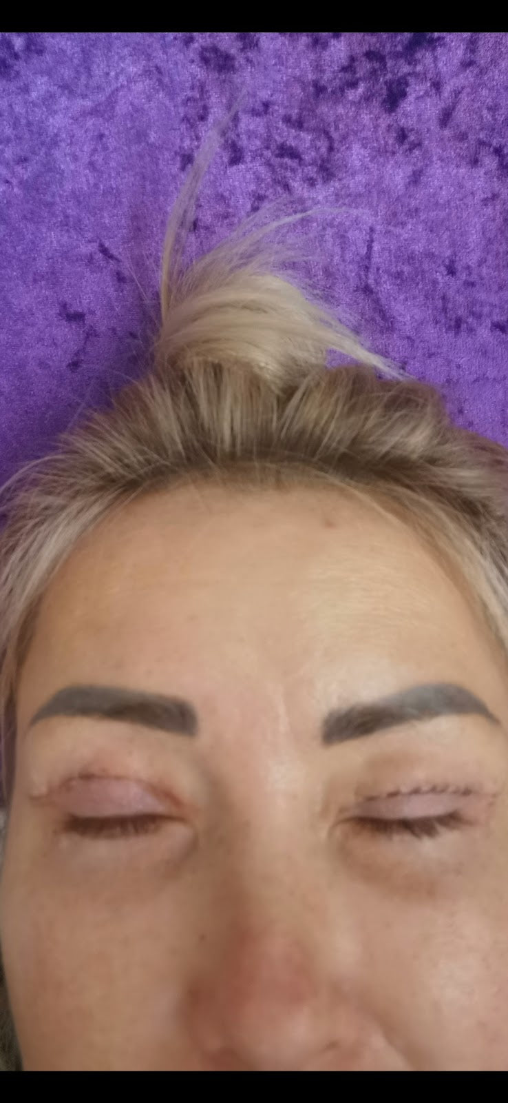 Signature Clinic Birmingham — Dr.Visor photo 5