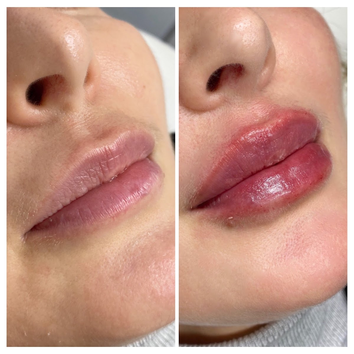 DRV Clinic - Aesthetic Surgery clinic in London W1U 6UD, United Kingdom