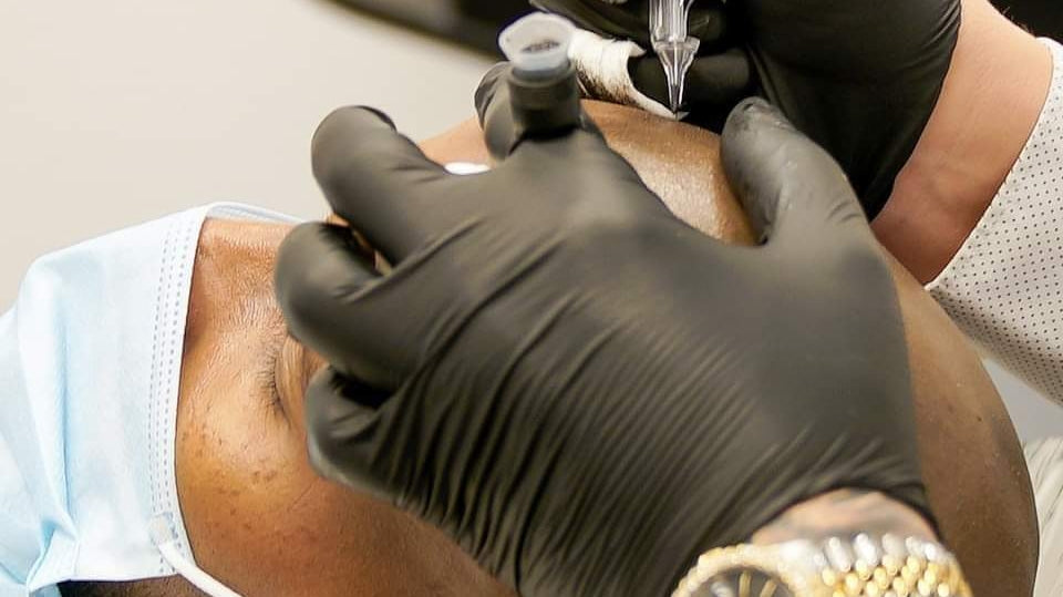 SCALPRO | Scalp Micropigmentation | Hair Transplant | Denver, CO