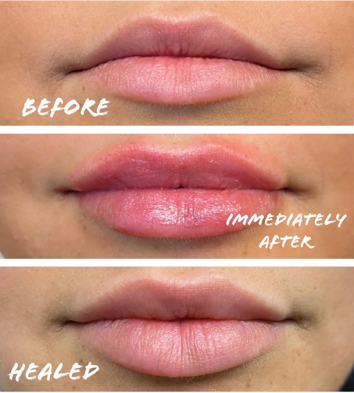 Skintuition Medical Aesthetics | Hair Transplant | Pocatello, ID