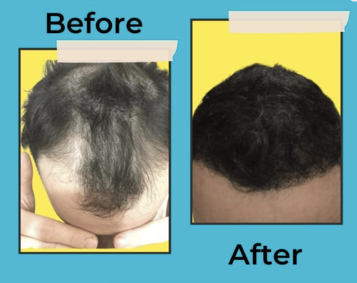 Harley Street Healthcare - Hair Transplant Clinics — photo 3