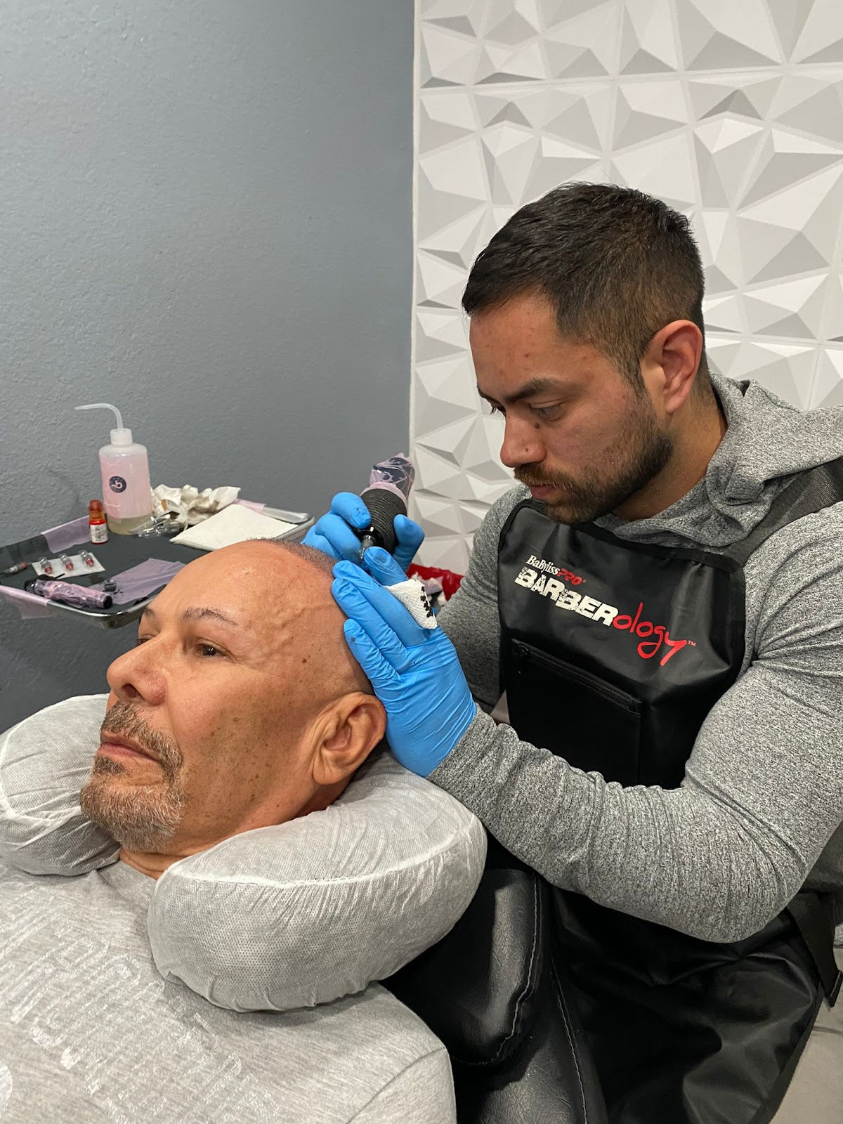 Pinnacle SMP | Hair Transplant | Centennial, CO