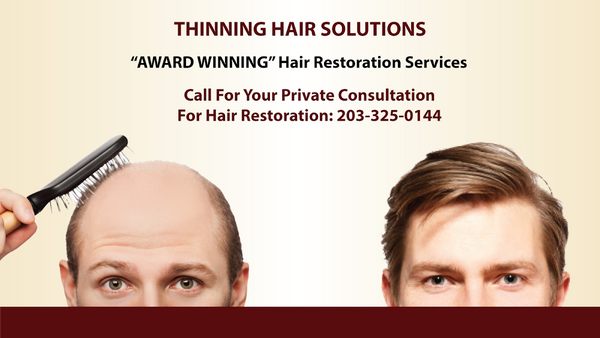 Thinning Hair Solutions | Hair Transplant | Stamford, CT