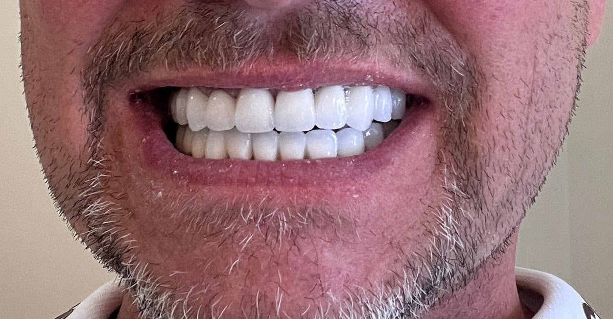 Quality Premium Dental Clinic — Dr.Visor photo 3