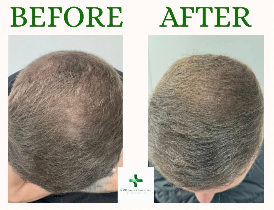 PRP Hair And Skin Clinic — photo 3