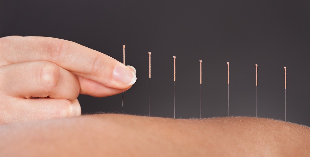 Verve Acupuncture & Fertility Support — IVF Clinic in Birmingham