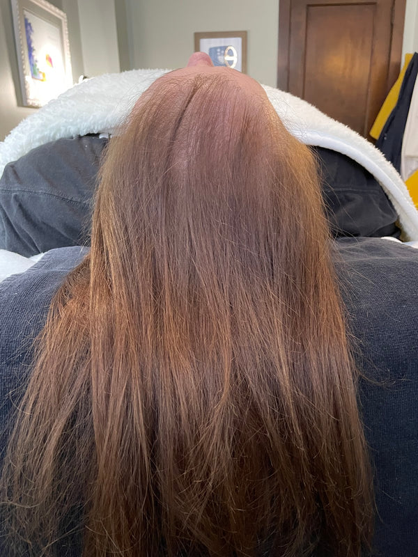 Healing Room | Hair Transplant | Lawrence, KS