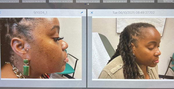 Green Dermatology | Hair Transplant | Milford, DE