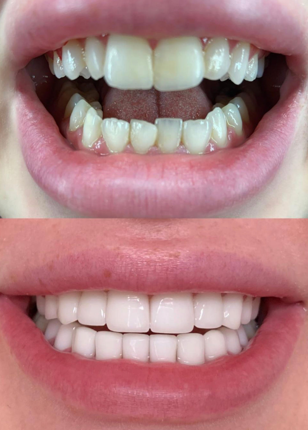 Dental Centre Turkey — Dr.Visor photo 4