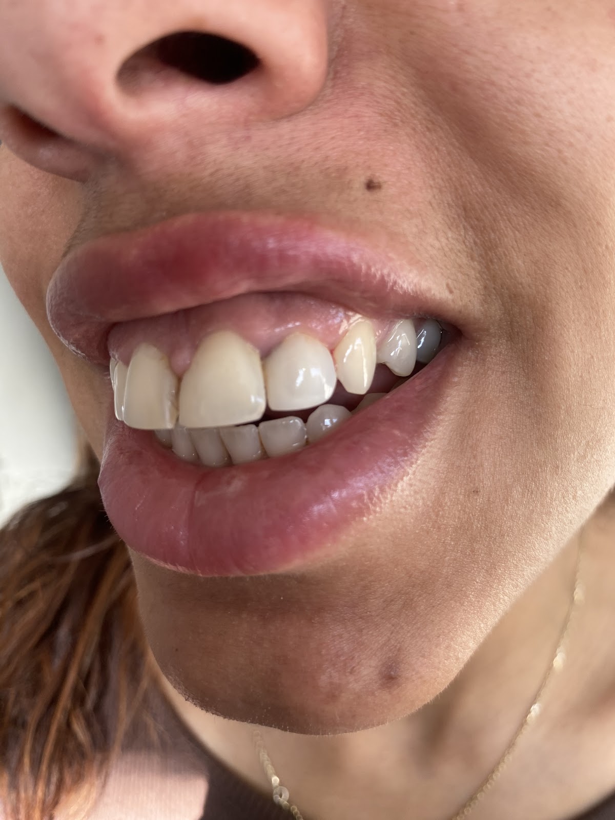 City Dental - Leeds — Dr.Visor photo 2