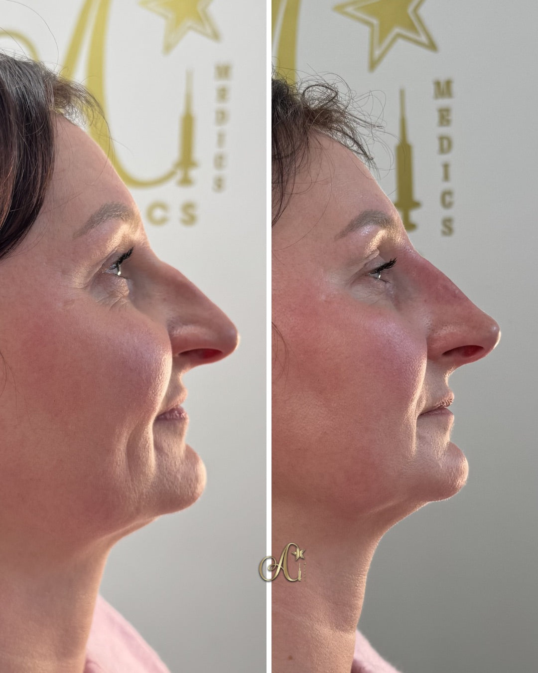 A Star Medics - Aesthetic Surgery clinic in Bradford, United Kingdom