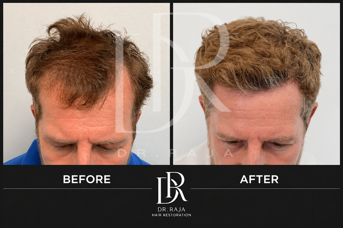 Dr. Raja Hair Restoration — photo 2