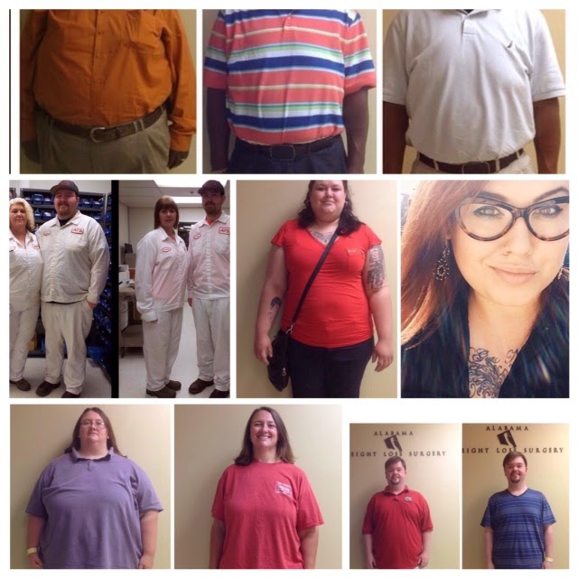 Weight Loss Surgery | Bariatric Surgery | Birmingham, AL