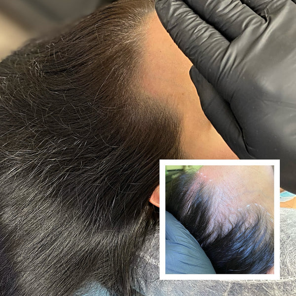 The Scalp Shop (scalp micropigmentation) | Hair Transplant | El Paso, NM