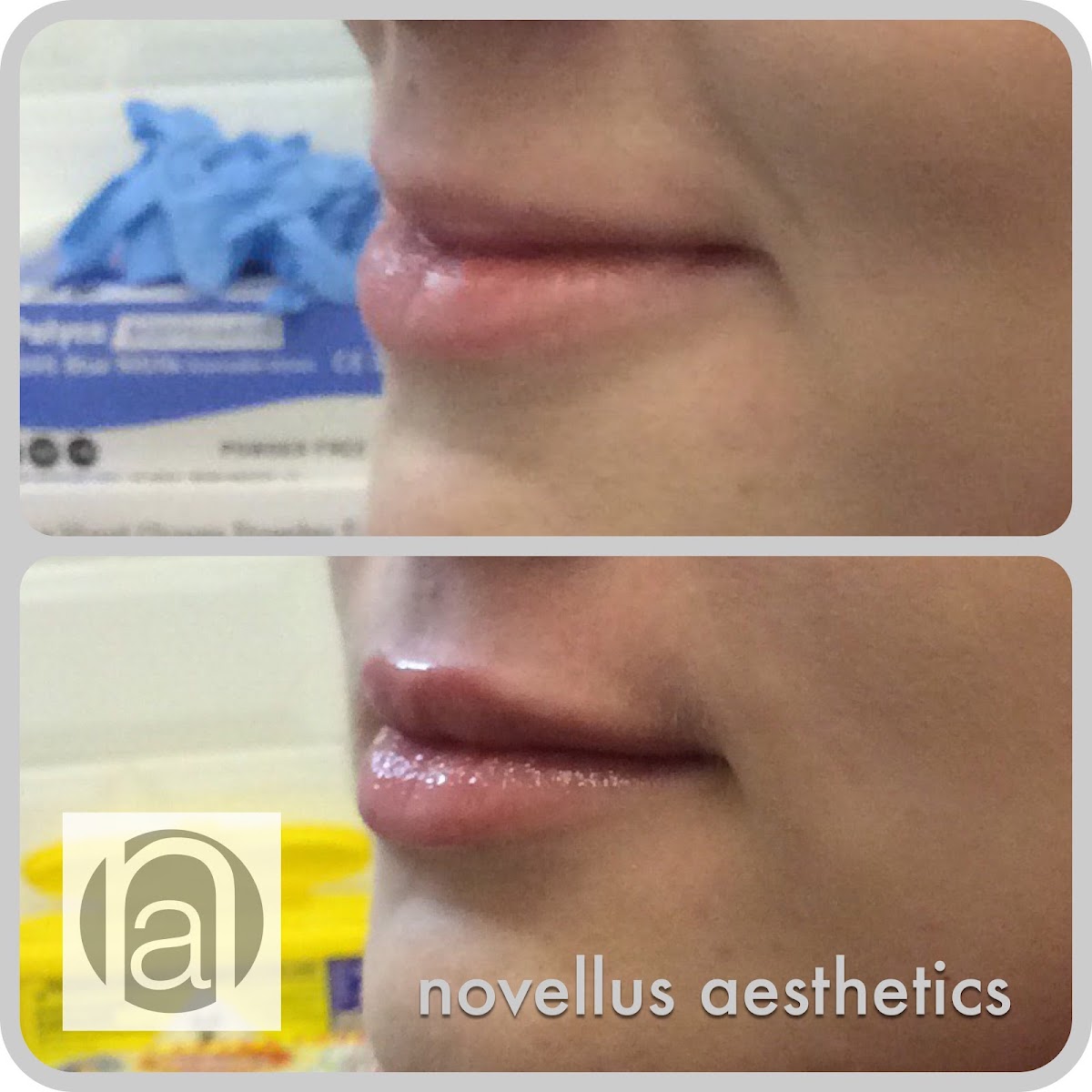 novellus aesthetics — photo 5