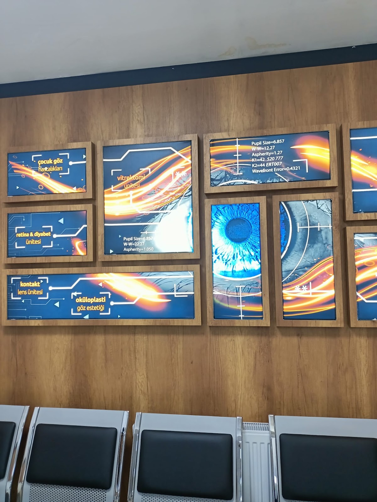 Bursa Eye Center — Dr.Visor photo 3