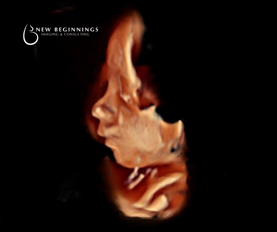 New Beginnings Imaging & Consulting | IVF | Minot, ND