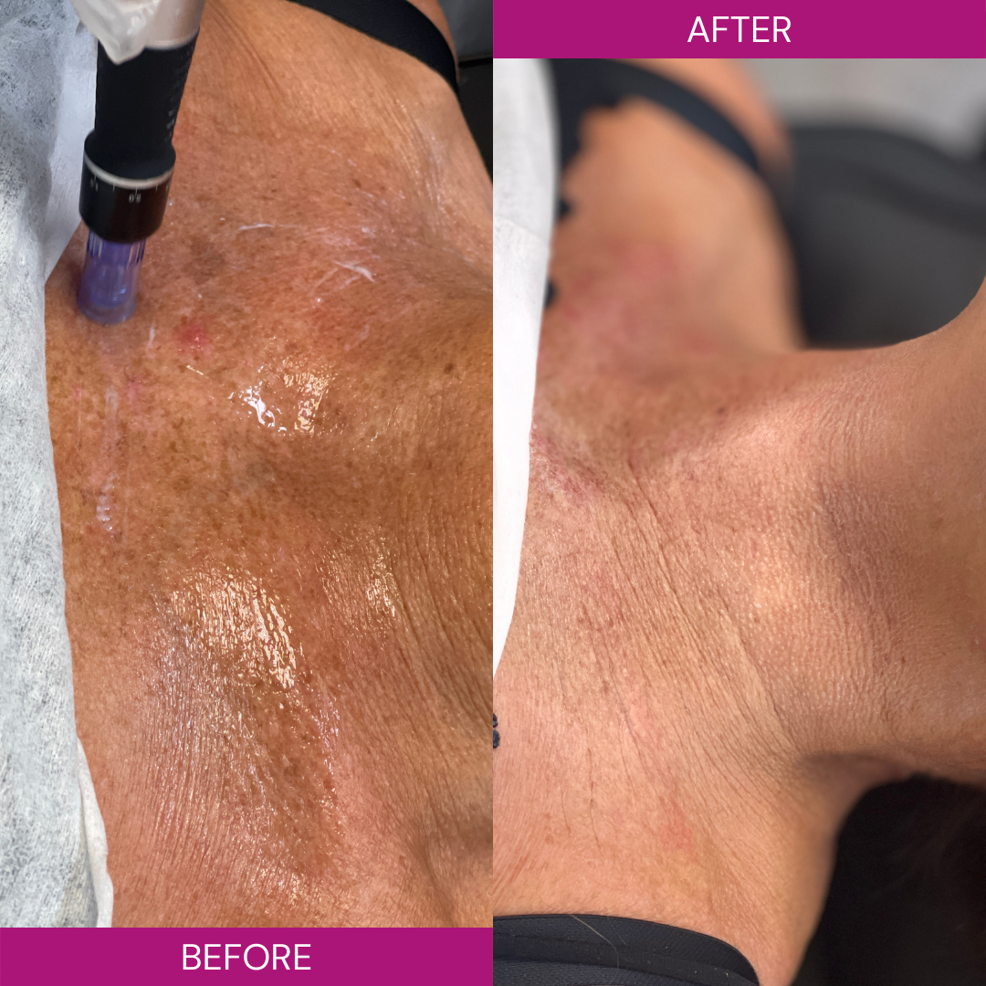The Glam Fairies | Aesthetic Clinic | Microneedling Birmingham | PRP Birmingham | Chemical Peel Birmingham — photo 3
