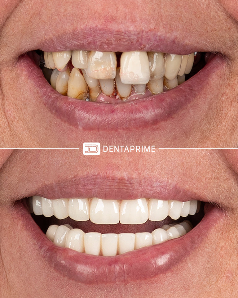 Dentaprime UK — photo 3