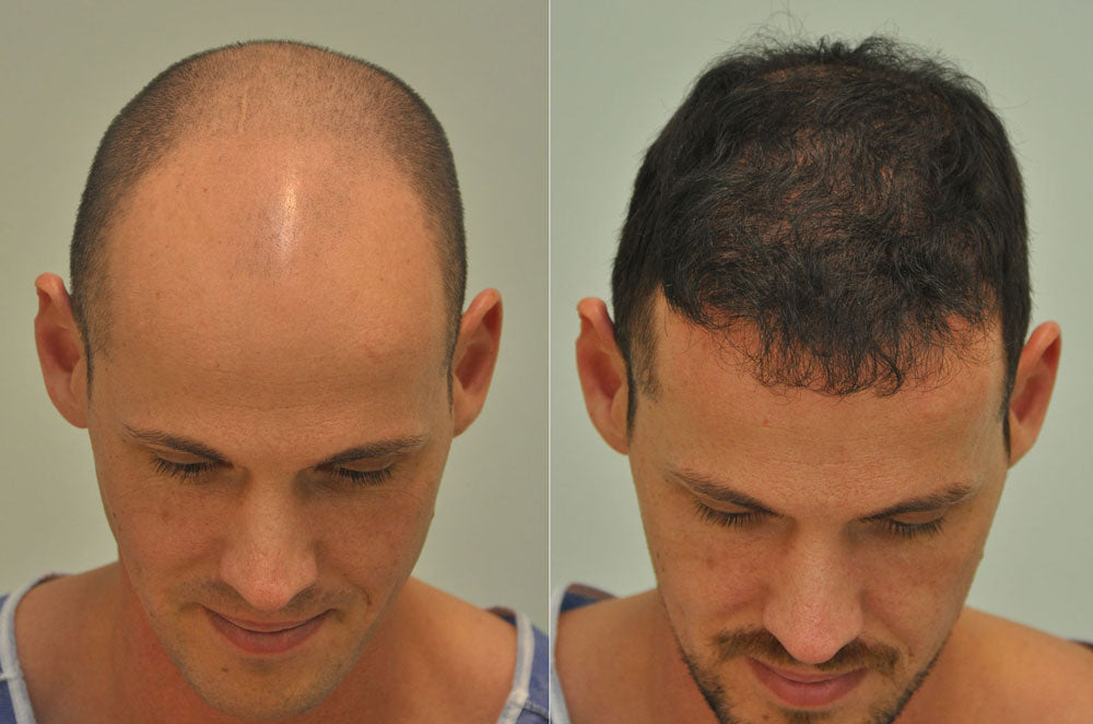 Dr. Sikos Hair Transplant Clinic and Plastic Surgery - Hair Transplant clinic in Edömér u. 6, Hungary